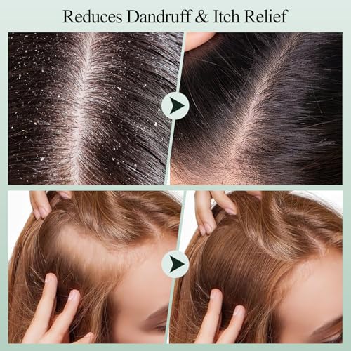 Rosemary Scalp Scrub for Deep Clean & Buildup Removal