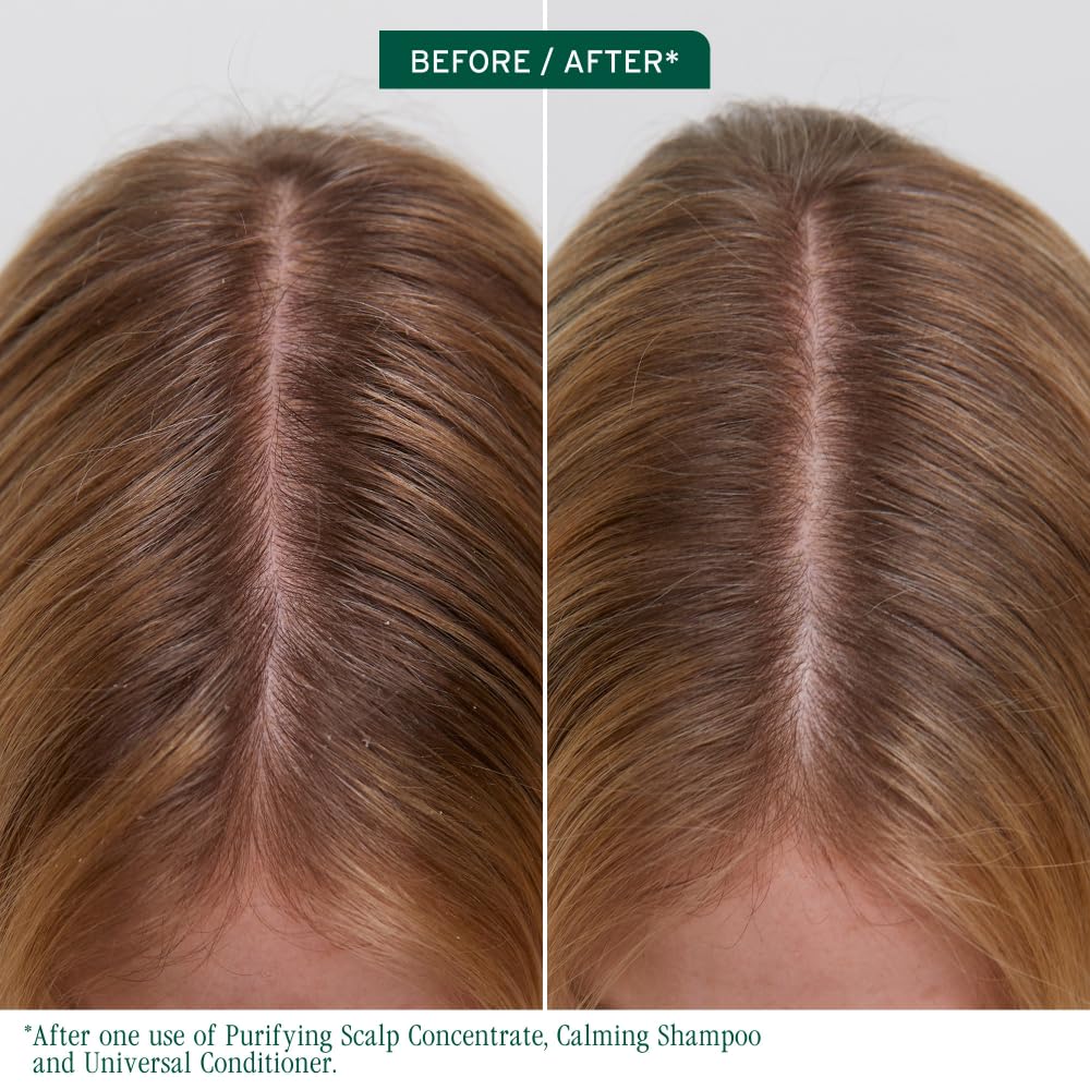 Clarifying Scalp Treatment for Buildup & Oil Control