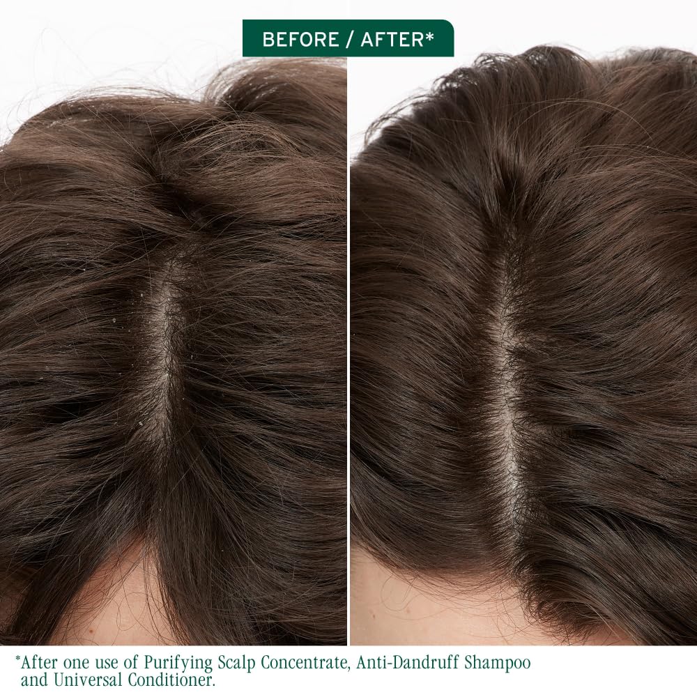 Clarifying Scalp Treatment for Buildup & Oil Control